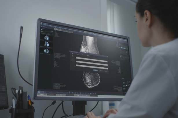 La convocatoria activa, según Vinicius Tadeu Sattin Rodrigues, aumenta la adhesión al cribado y rompe barreras de olvido y miedo.